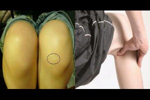 收藏！不用吃藥打針，每天10分鐘簡易操，讓膝蓋軟骨重生！