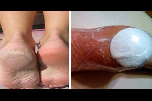 她腳底包著棉球睡覺，隔天當她醒來時...驚人的事情就發生了！