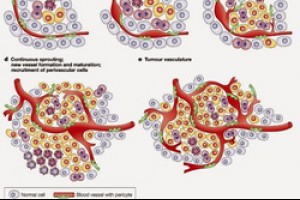 感冒時有綠色的痰或者鼻涕，不須抗生素治療! @ 鄭醫師的部落格 :: 痞客邦 PIXNET ::