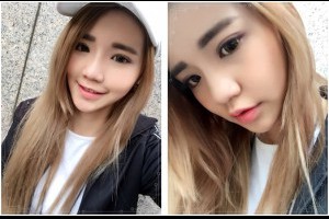 【台中公主玻尿酸推薦】推薦台中打肉毒瘦小臉及喬雅登隆鼻麗醫美診所，公主玻尿酸打山根也很厲害耶～我超喜歡現在的臉型～變身外國人啦！ @ 小王子的790114號星球 :: 痞客邦 PIXNET ::