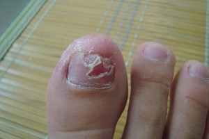 原來我錯了30年...腳指甲竟然要這樣剪才對！ LIFE生活網