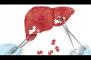 嘴乾口臭、容易疲勞...跟「肝不好」沒關係！破解「保肝產品」的3大迷思 - 健檢報告沒寫的人生故事 - 養生 - 良醫健康網 - 商業周刊（百大良醫）