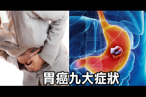 每日健康 Health - 愛吃油炸當心「胃癌」上身！一秒檢測「九大早期徵兆」：噁心、腹脹、胃灼熱都進榜｜每日健康 Health