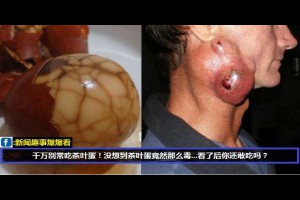 茶葉蛋驚人的秘密！沒想到茶葉蛋那麼毒！專家勸你少吃微妙... 快看，不然遲了後悔都來不及了...！以後我再也不敢吃了...