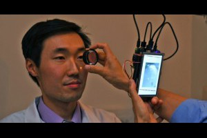生活技.net: 新型紅外視網膜相機有望取替散瞳眼藥水