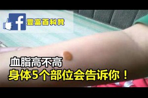 血脂高不高，身體5個部位會告訴你 