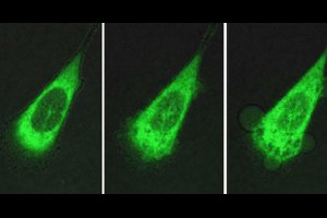 生活技.net: 科學家發明可數分鐘內殺死癌細胞的納米機器