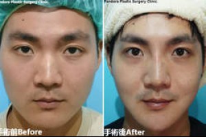 美國芝加哥研究:年長者每天吃一份綠葉蔬菜大腦年輕11歲!