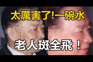 太厲害了！一碗水，老人斑全飛！瞬間年輕30歲……