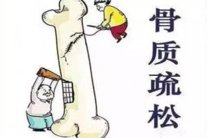 「骨質疏鬆」不用花大錢買保健品！ 只要做好三件事 , 45歲擁有20歲的骨骼 ! ！