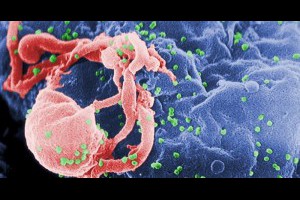 生活技.net: 法國科學家成功摧毀感染HIV病毒細胞