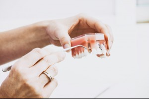 矯正牙齒到底要不要拔牙？拔牙議題「大解密」 | WECARE・康世維口腔美學