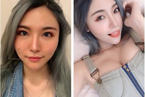 【微整形】玻尿酸/肉毒顏值提升~台中醫美診所首選!抬頭紋消失了!美顏推薦●回頭率upup!! @ 愛情的起點 :: 痞客邦 ::