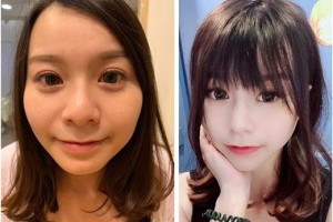 果醬女孩:〈玻尿酸〉法令紋˙淚溝問題!! 保養有方法～微整形推薦！台中必訪醫美診所.