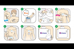 ECG & EKG Electrodes | Best Medical Electrodes for ECG Device - QT Medical