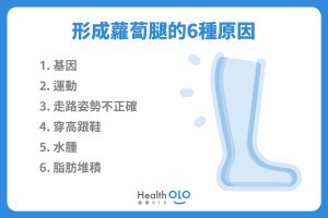 蘿蔔腿是什麼？瘦小腿運動怎麼做？如何避免蘿蔔腿？ - 健康010