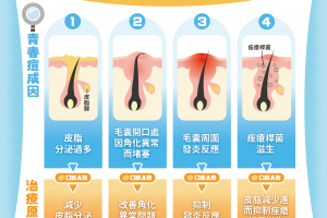認識青春痘救星「口服 A 酸」！一次看懂治療作用、使用注意事項 - Heho健康
