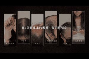紋髮是什麼？全面了解這項新興技術 | HR形象管理美學｜首席頭皮紋髮｜5D絨密紋髮｜SMP紋髮｜紋髮教學｜台南紋髮｜髮際線｜瘦小臉
