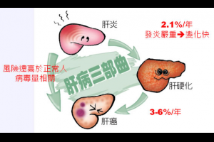 新聞資訊feed站: 中醫如何治療肝硬化與肝腫瘤