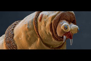 25種你不想在顯微鏡下看到的東西