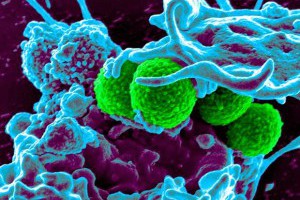 生活技.net: teixobactin - 超級耐藥性病毒剋星