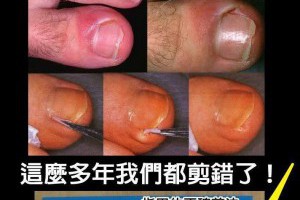 《腳指甲的正確剪法，這麼多年我們都錯了！》 | Giga Circle