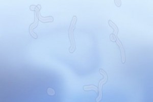多螢世代眼過勞、小心飛蚊症纏身：認識飛蚊症，揮之不去的惱人現象