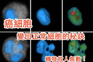 癌症不可怕!重要的是如何把癌細胞變回正常細胞，秘訣就在這!! 轉發救人無數！;Shareba!分享吧